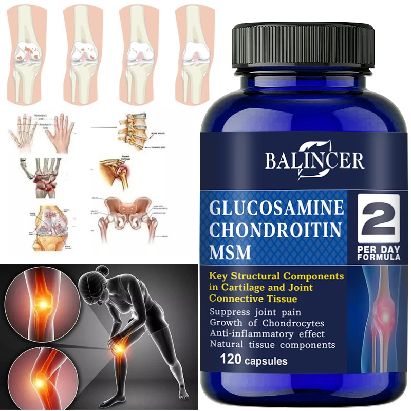 Glucosamine Chondroitin Relieves Joint Inflammation and Supports Cartilage Repair Dietary Supplement Bone Health Complex