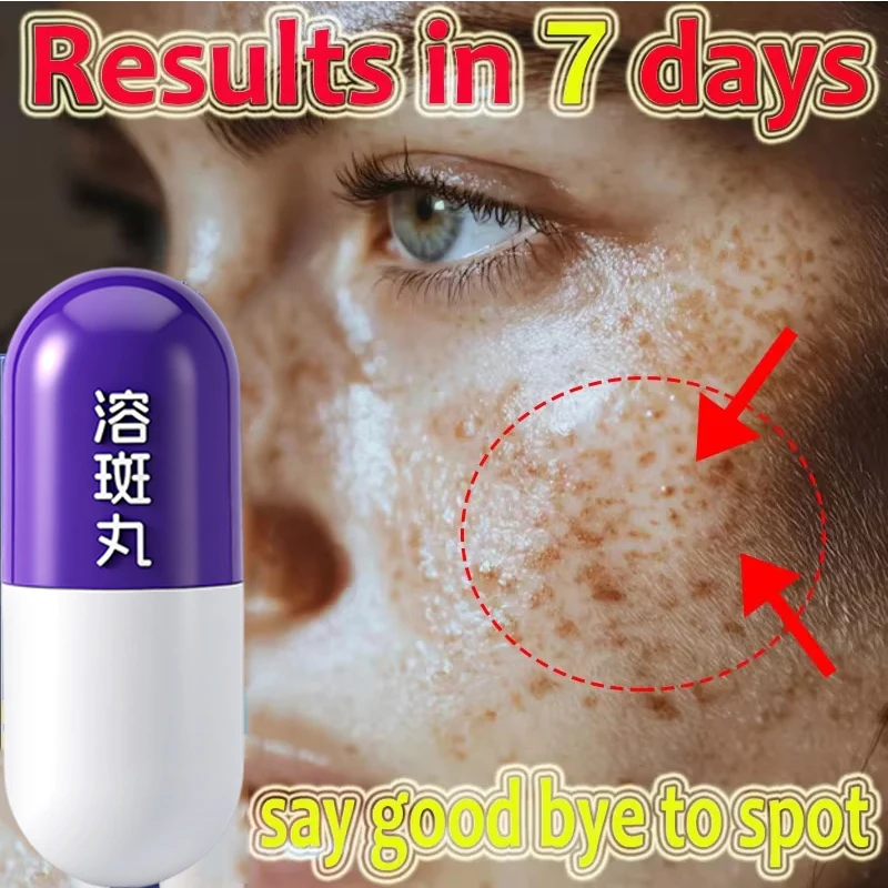 فعال تبييض النمش إزالة أكوا جوهر 377 بقعة حبوب تذويب إزالة الكلف تتلاشى التصبغ سطع العناية بالبشرة #1