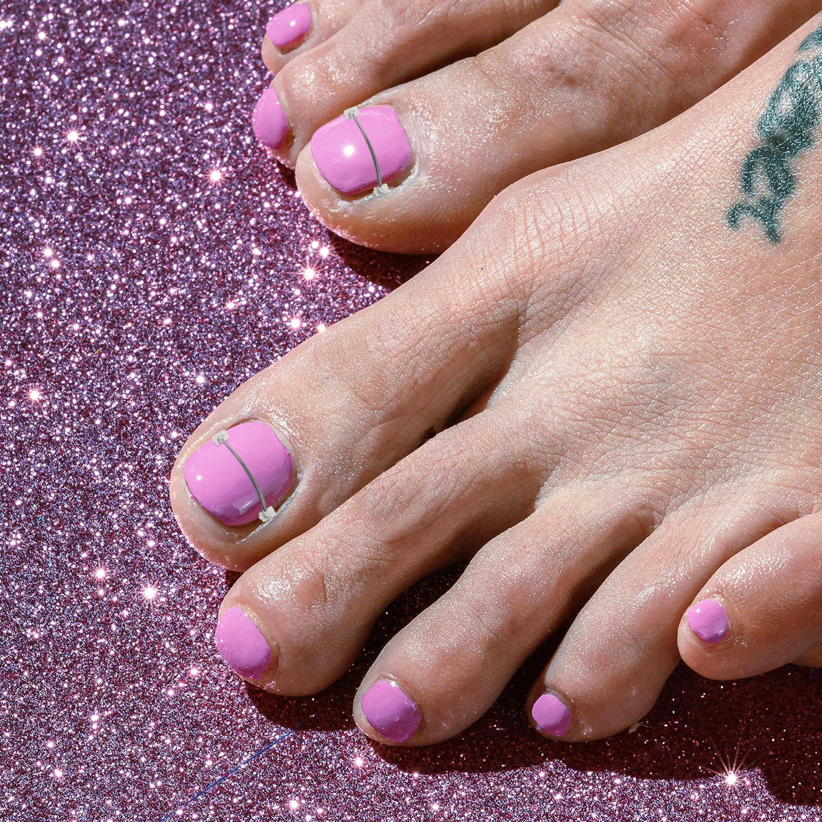 5 pezzi trattamento unghia incarnita set di cavi in lega di titanio riparazione unghie curve strumenti per pedicure kit di correzione unghie del piede