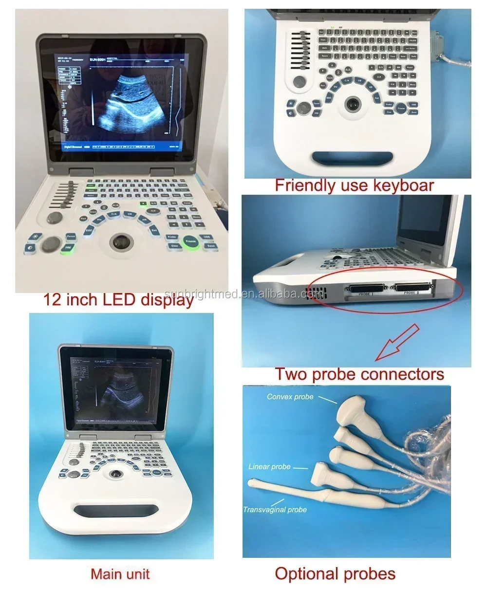 SUN-806G Ultrasound BW Portable Full Digital Portable laptop Ultrasound Instrument BPD,GS,CRL,FL,HC,OFD,TTD,AC 8 measurement