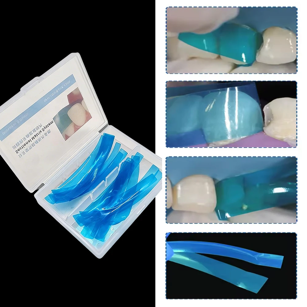 15Pcs Contoured Anterior Dental Matrices Strips for Class III IV Resin Restorations Cosmetic Dentistry Tool