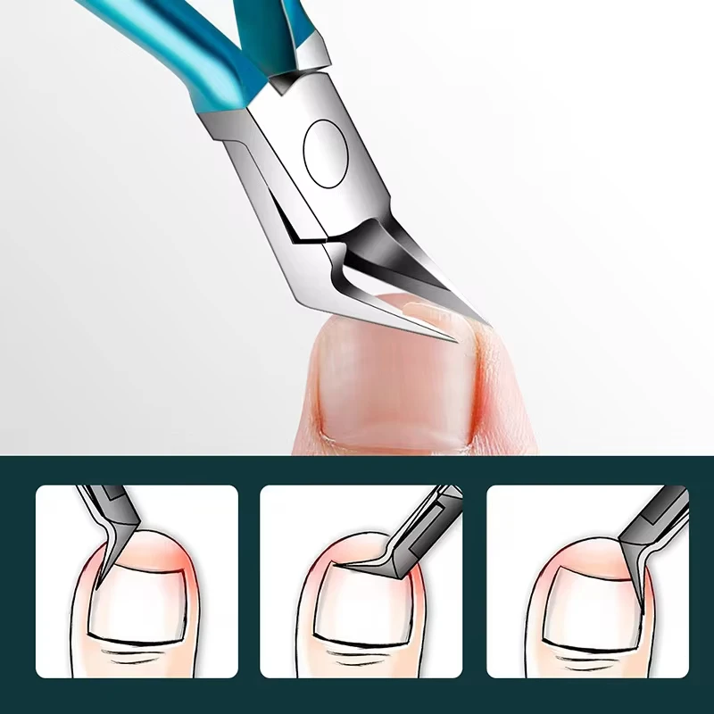 Professioneller Nagelschneider, Nagelhautzange, Schere für eingewachsene Zehennägel, Nagelknipser, Edelstahl, Entfernung abgestorbener Haut, Pediküre-Werkzeug