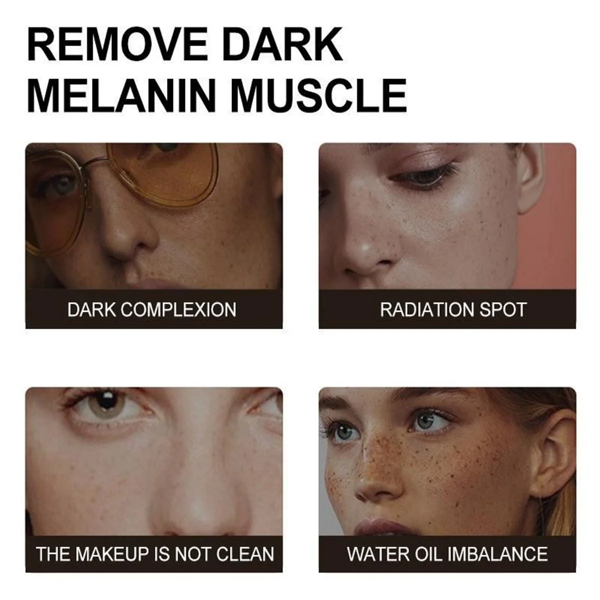 أربوتين 5% ميلانين يزيل كريم الوجه ويقلل البقع ويقليص المسام ويضيء لون البشرة ويحكم في الزيت