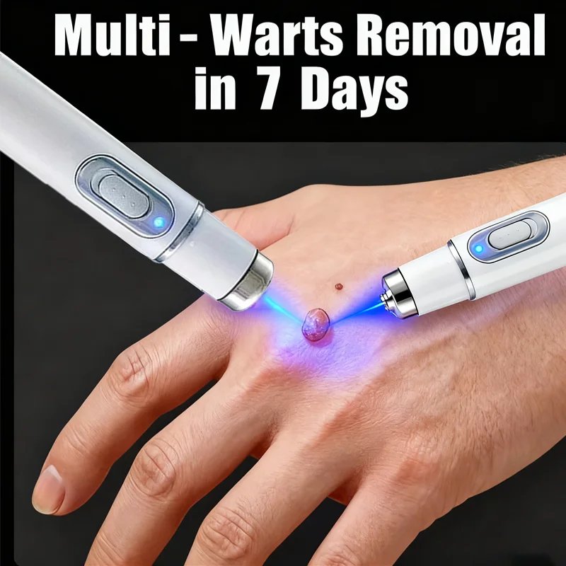 Wyprzedaż, długopis na brodawki z niebieskim światłem, narzędzia do pielęgnacji brodawek, unisex 26