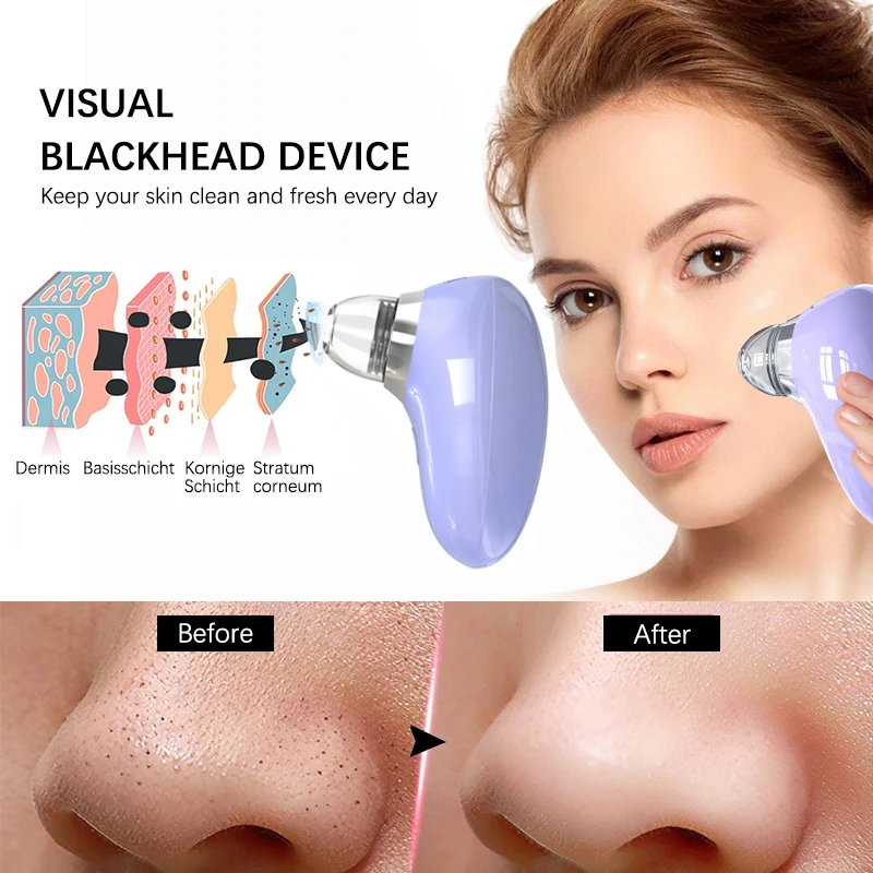 Blackhead Remover 3 Suction Mode Visual Acne Pore Cleaner Machine Electric Nose Black Head Face Deep Cleansing Skin Care Device