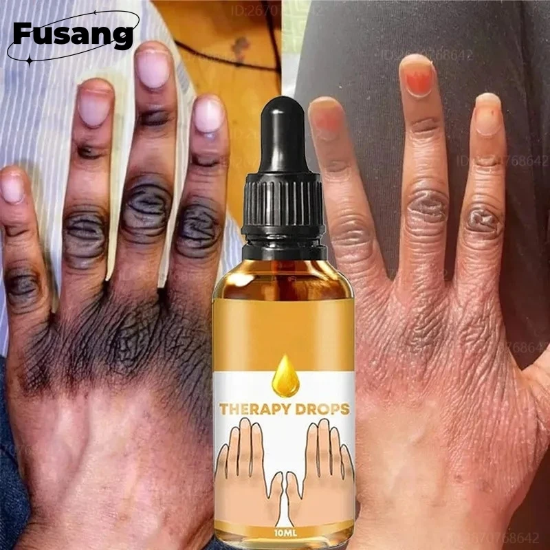 Black Knuckles Fast Brightening Serum Hand Knuckle Elbows Knee Intense Stains Remover Essence Dark Skin Pigmentation Essence