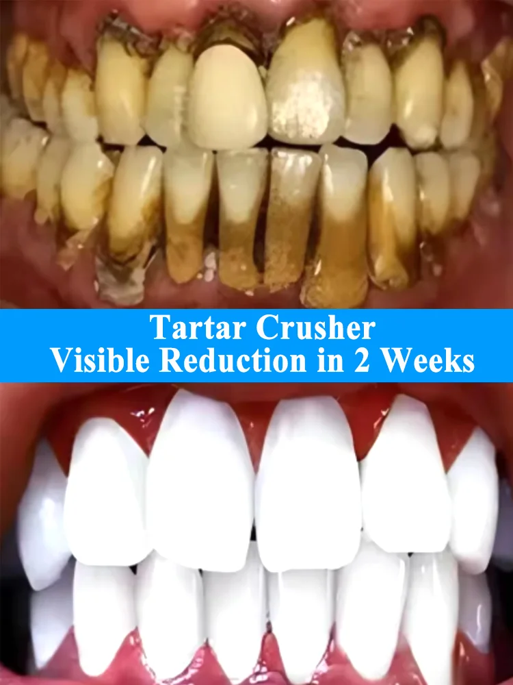 

oral cavity Whitening Toothpaste Removes Tartar Plaque and Yellow Teeth Stains While Brightening Teeth and Preventinting