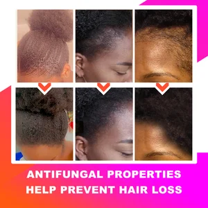 Afrikanisches afrikanisches Haarpulver, 100% natürlich, superschnelles Haar, Anti-Cabelo, Pause, lokale Zutaten mit modernem Handwerk, 100g 9 Hauptverkaufspulver von Chebe - №8