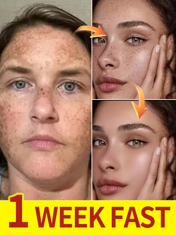 

Vitamin C Facial Essence Contains Hyaluronic Acid Dark Spot Remover Moisturizing Repair Anti-aging Essence Facial Skin Care 30ml