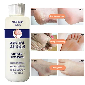 120ml Zmiękczacz do peelingu stóp Złuszczający modzele Maska do stóp Przeciw pęknięciom Wzmacniacz pięty Profesjonalny zestaw do pedicure do polerowania paznokci