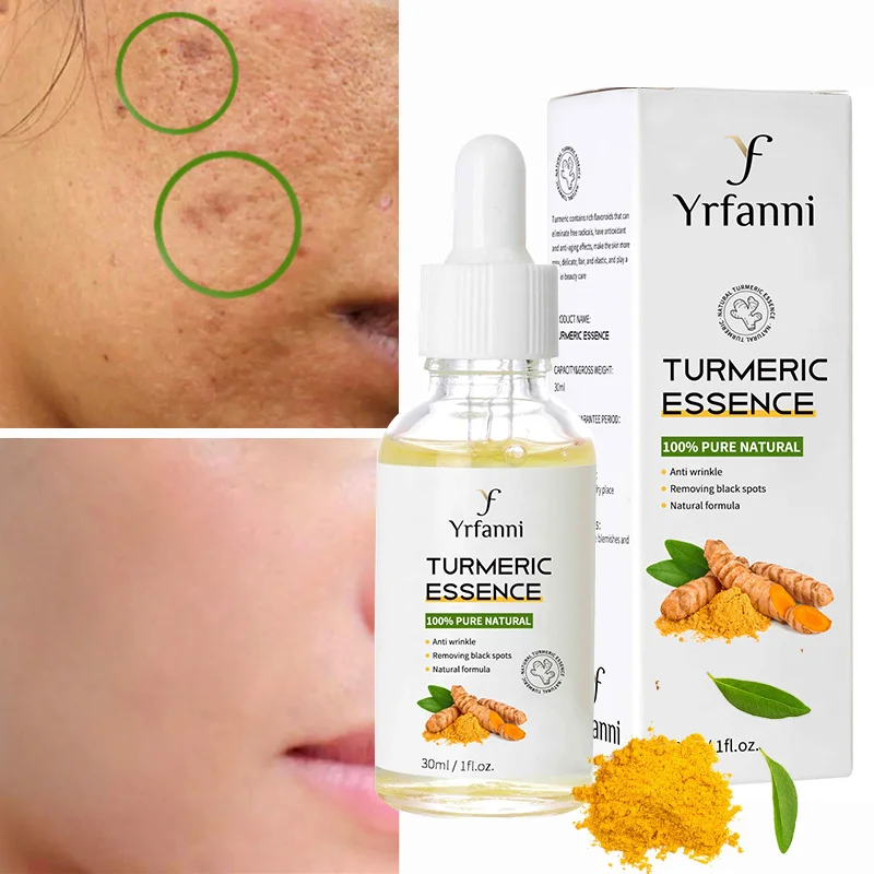 

Turmeric Freckle Whitening Serum Dark Spot Correction Essential Oil Anti-Wrinkle Reduce Acne Marks Improve Blackheads Face Serum