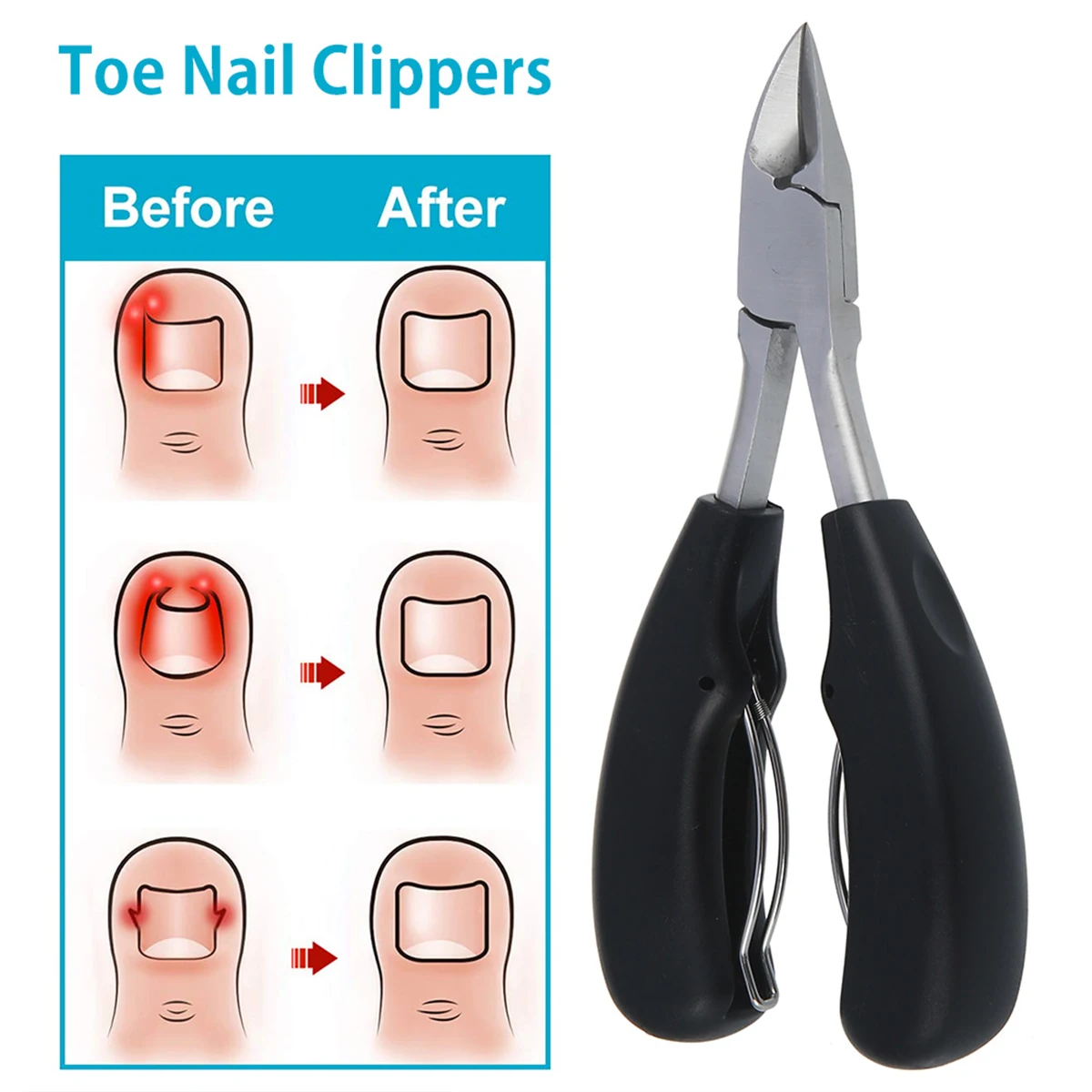 Zehennägel Trimmer Zehen nagel Pflege Clipper für ein gewachsene oder dicke Nägel Nagel haut Nipper Trimmer alter Mann Schutz Sanitäter Schere
