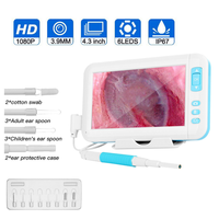 HD Screen Otoscopio Camera, Digital Ear Monitor, Earpick Ear Cleaner, Otoscope, Endoscope Camera, 3.9mm, 4.3 Inch, 1080P