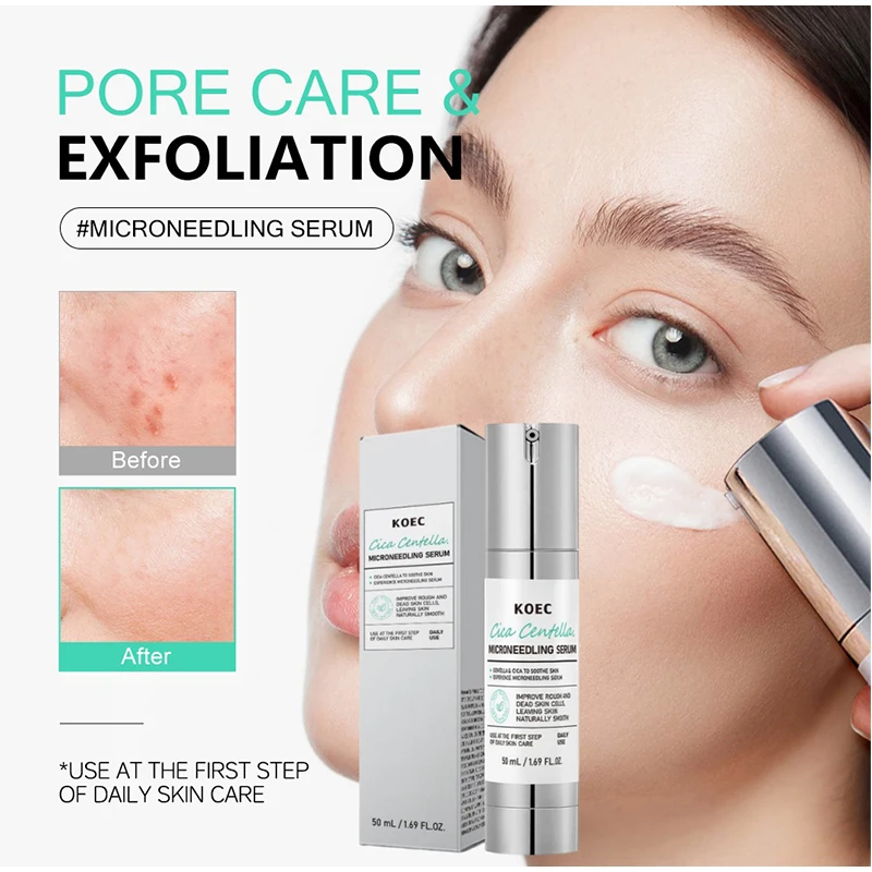 Soothing Microneedle Serum, Centella Asiatica & Propolis For Skin Barrier, Pore Care Exfoliating Korean Glass Skin Essence 50g