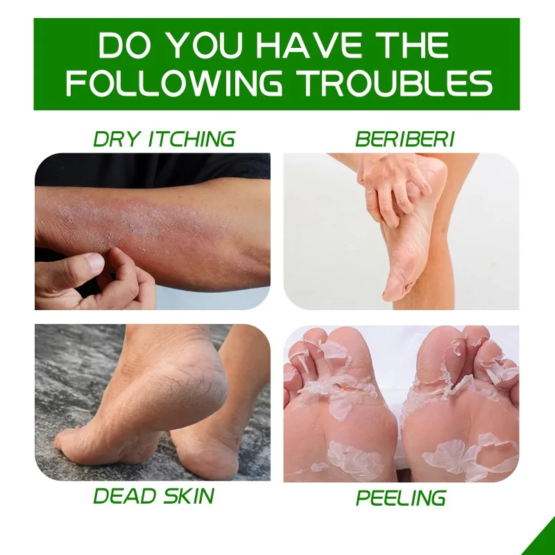 Foot care cream heel Dead skin removal Callus anti dry Cracked peeling hydrating moisturize exfoliation chapped repair feet mask