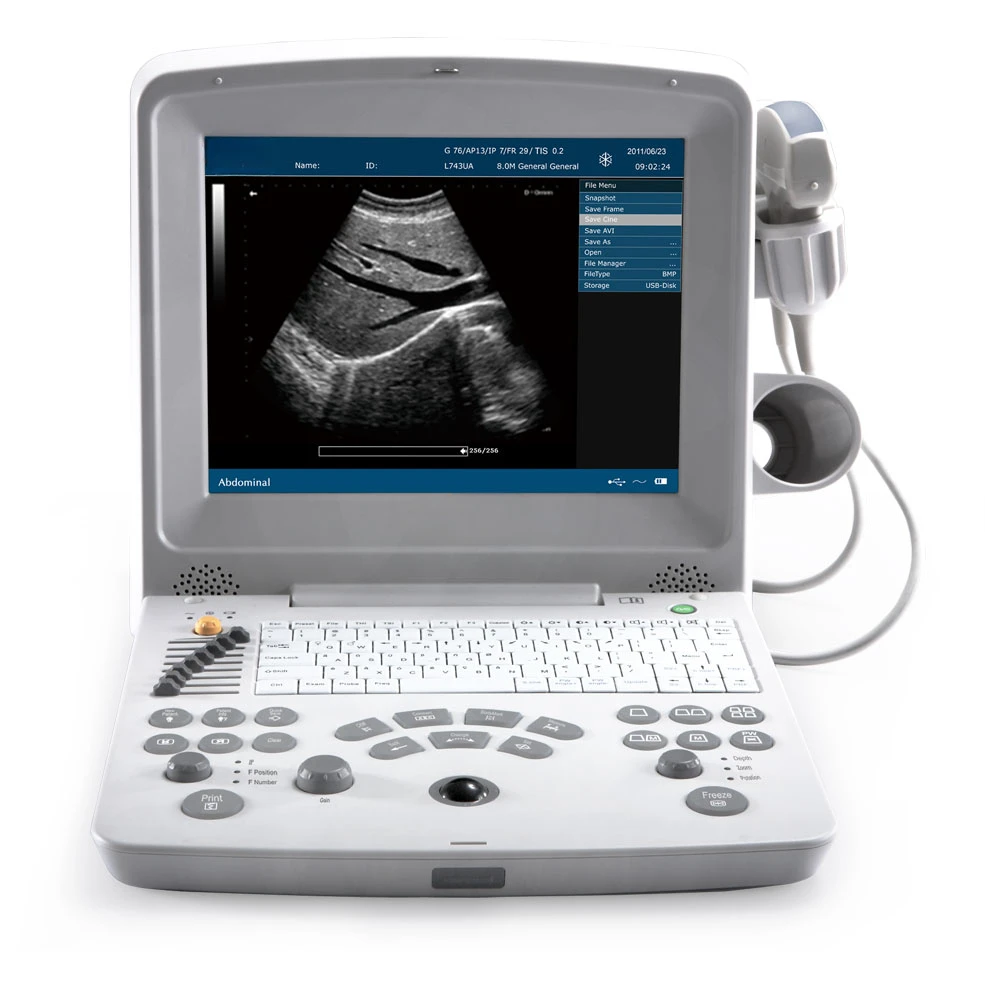 portable Edan ultrasound machine black and white ultrasound machines