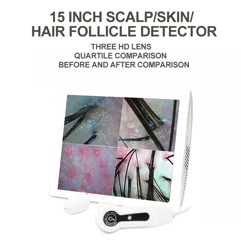 15 Inch Screen Ultra Hair Skin Analyze HD Intelligent Beauty Salon Home 50/200 Times Lens HD Scalp Hair Detector Skin Analysis