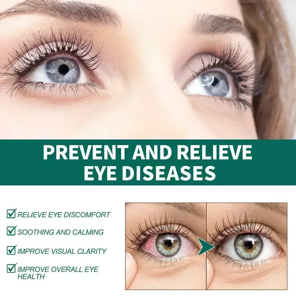 Eye Drops Relieves Eyes Discomfort Blurred Eyes Sore Eye Care Itchy Relax Dry Swelling Massage Clean