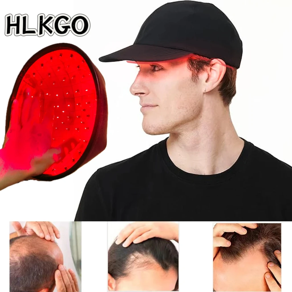 LLLT Phototherapy Device for Hair Loss, Low Level Laser Treatment for Scalp and Hair Follicle Nourishment
