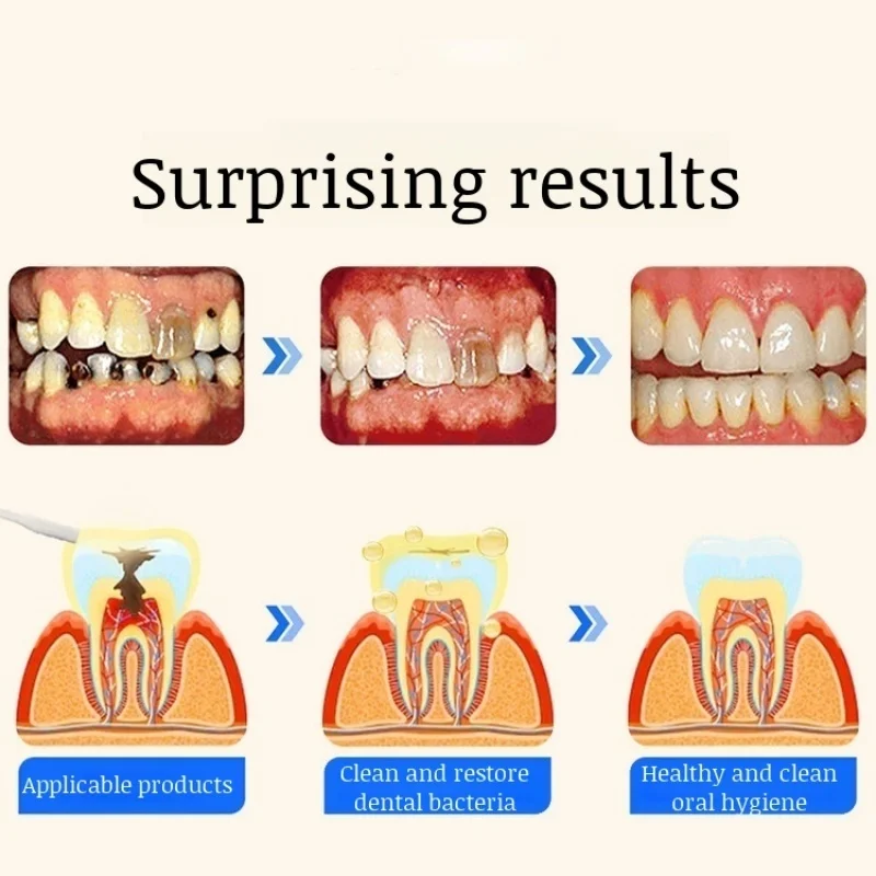 สเปรย์โพลิสสเปรย์ทำความสะอาดคราบหินปูนกลิ่นลมหายใจสดชื่น