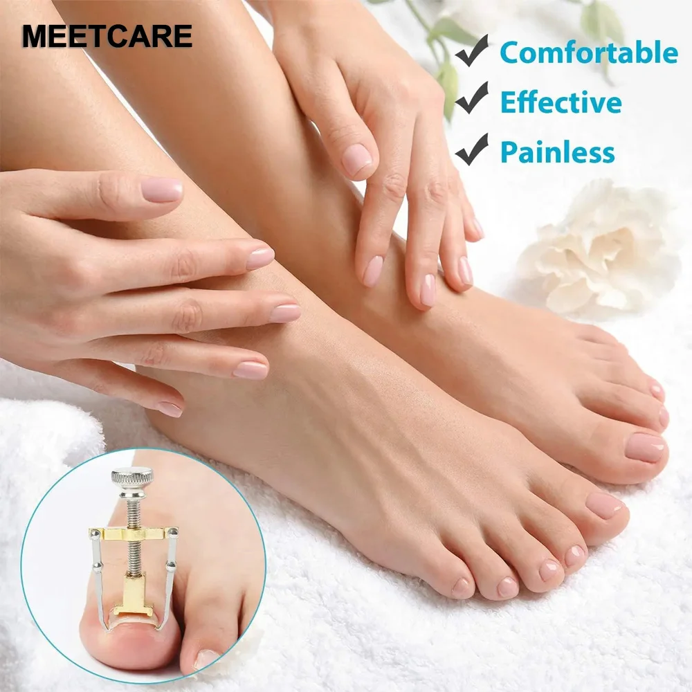 correcao-de-unhas-encravadas-ferramentas-de-pedicure-para-cuidados-com-unhas-dos-pes-lixa-adesivo-elastico-clipe-alisador-bracadeira-corretora-fixador-de-fio