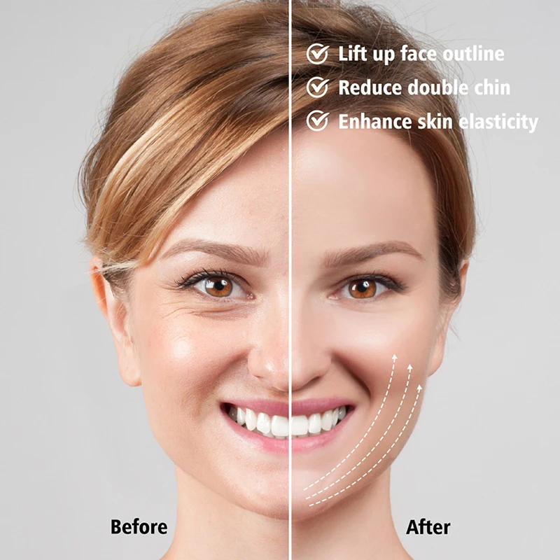 여성용 탄력 있는 얼굴 슬리밍 붕대, V 페이스 마스크, 턱 뺨 리프트 업 벨트, 얼굴 마사지 스트랩, 주름 방지 미용 도구