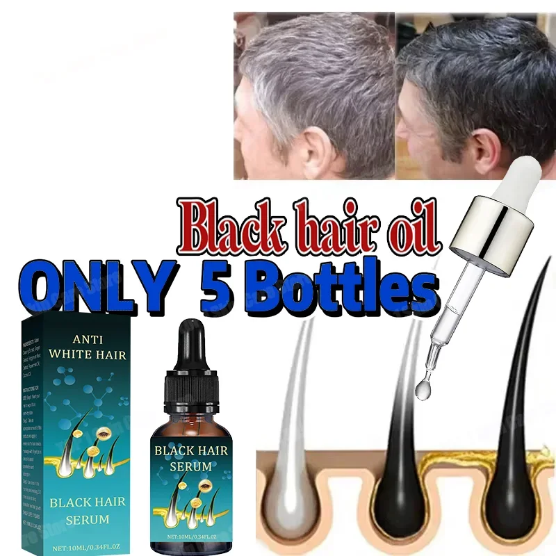 Natural Anti-Grey Hair Essence Serum No hair color,no allergies Anti-grey hair essence Serum Remedy Healthy