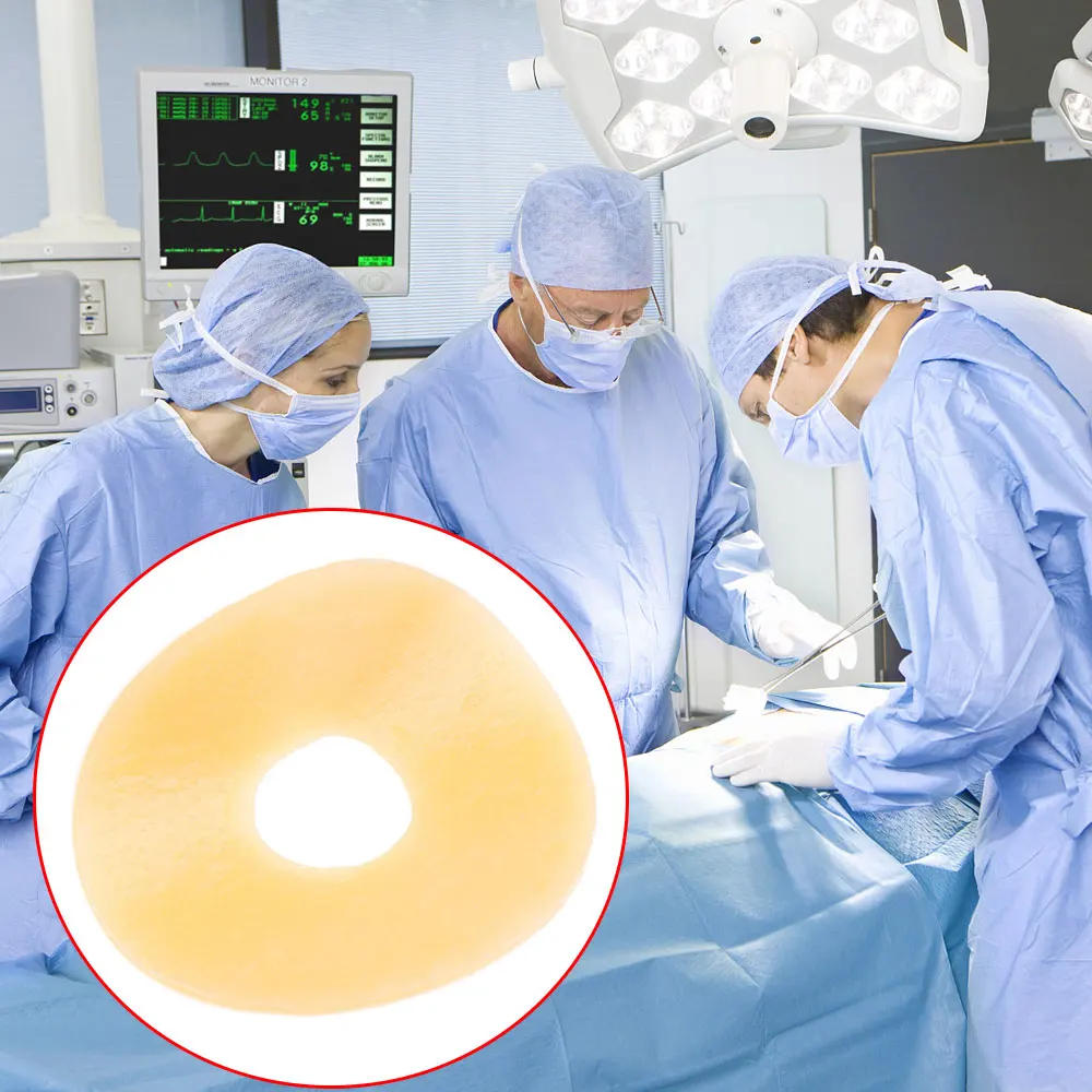 1-10 個人工肛門バッグ漏れ防止リングポータブルストーマバッグ用品保護バリアリングオストミーバッグ支援