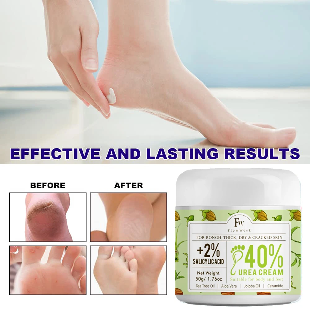 FlowWeek Urea Cream 40% plus salicylic acid 2%, foot cream, suitable for repairing dry and cracked heels, feet, knees, hands and