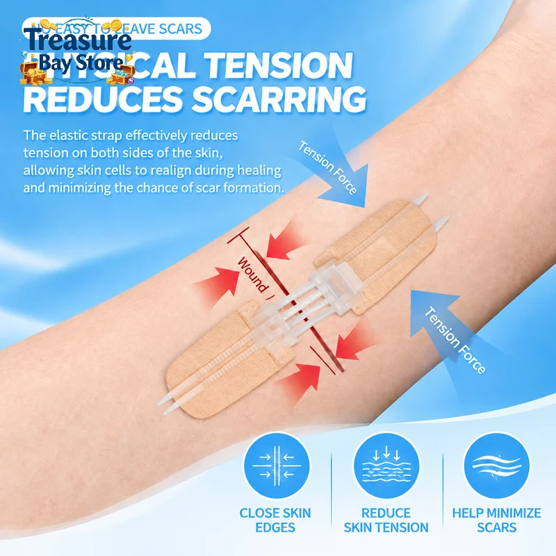 Zipper Wound Closure Patch Suture-free Zip Suture Reducer Painless Band Aid Outdoor First Aid Dressing