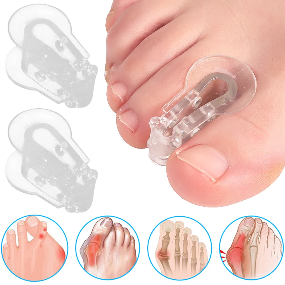 

2pcs=1pair Toe Orthosis Clip Adjuster Thumb Hallux Valgus Overlap Separators Pedicure Toes Bunions Corrector Pads Feet Care Tool