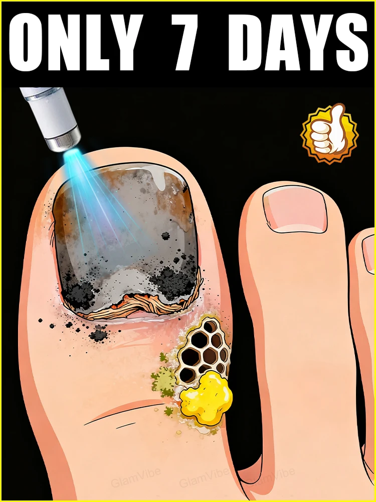 

Лазерное лечение ногтей и удаления онихомикоза