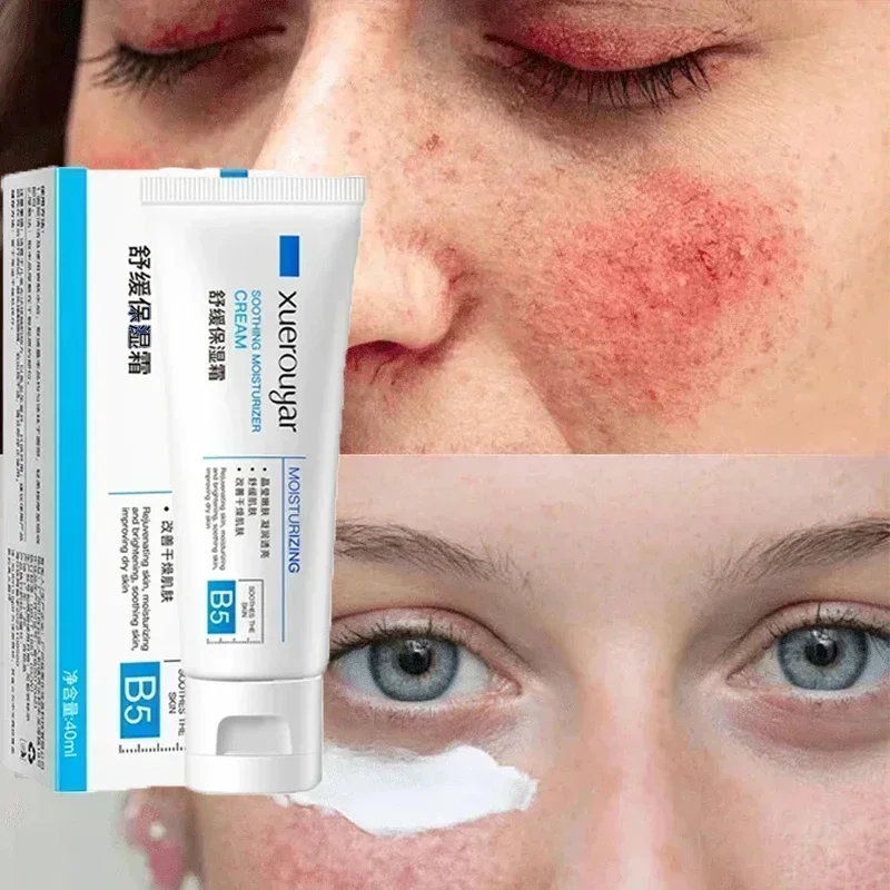 Krim pemeliharaan wajah, 7 hari memperbaiki kemerahan, menenangkan perbaikan kulit Rosacea darah merah meningkatkan perawatan kulit sensitif kosmetik Korea