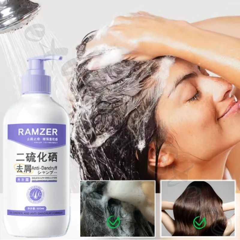 Selenium disulfide shampoo 500ml refreshes and fluffs the scalp, cleans hair follicles, strengthens hair and improves hair loss