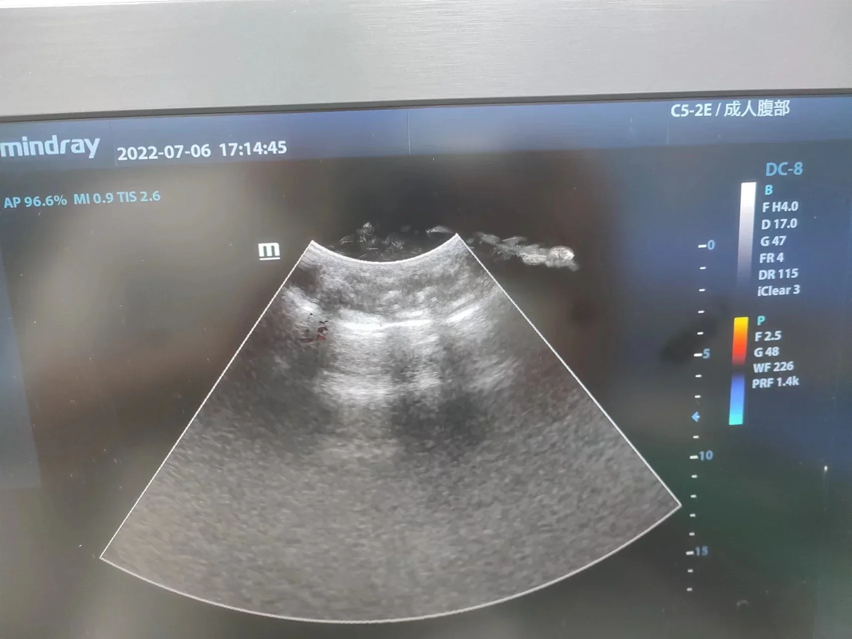 Mindray C5-2E Convex Ultrasound Transducer Probe Compatible Probe