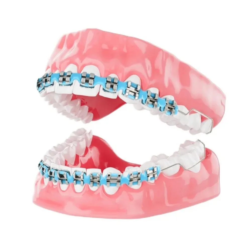1 Pair New Colorful Temporary Tooth Decoration with Box, Metal Wires Orthodontic Ligature Ties & Fake Braces Brackets Quality