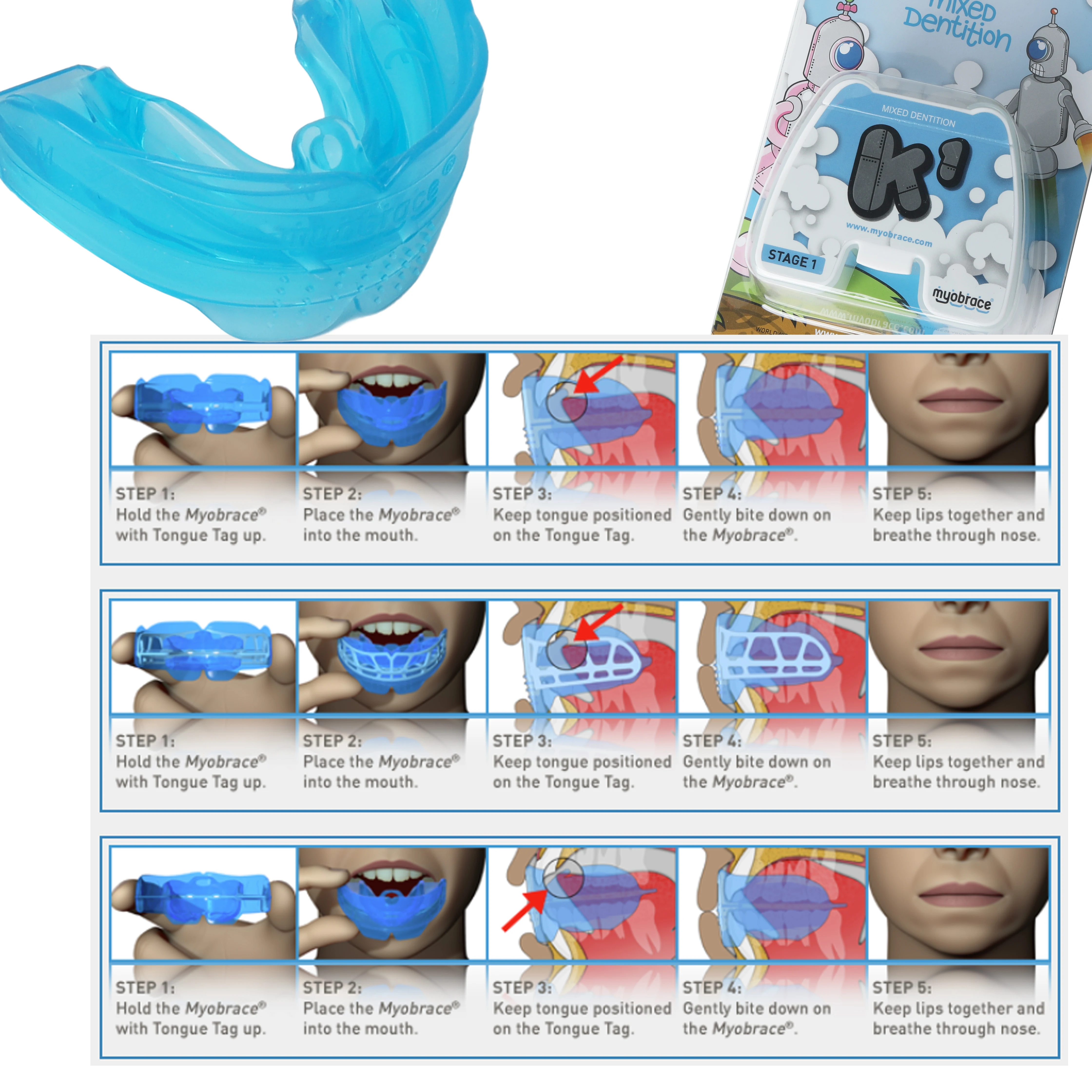 K1 K2,Dental MRC Orthodontics For Children Orthodontic Braces For Children Arch Shape,Jaw Development In Children 6-10 Years Old