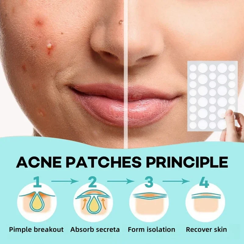 Invisible Acne Patches Removal Pimple Anti-Acne Hydrocolloid Patches Spots Marks Concealer Repair Sticker Waterproof