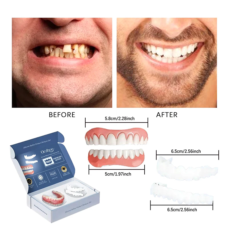 New Silicone Denture Set Adjustable False Teeth Set Top and Bottom Dentures Denture Reline Kit for Men Women