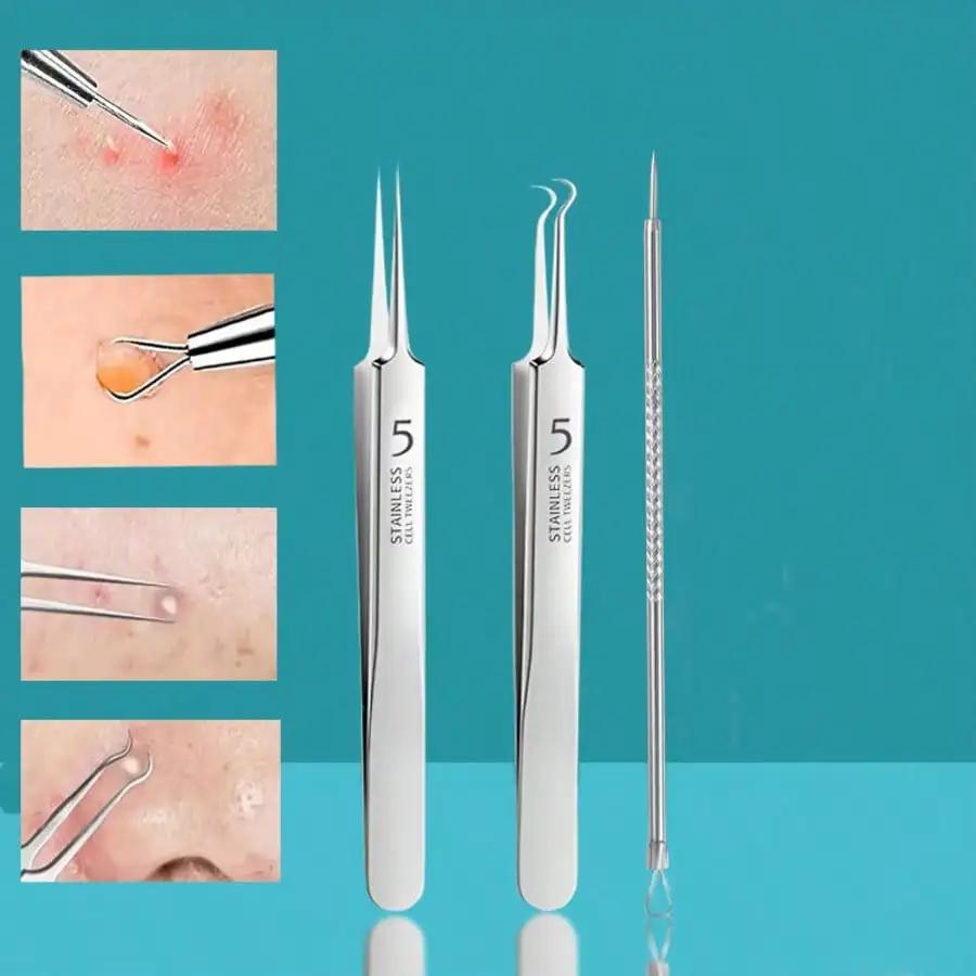 مجموعة مزيل الرؤوس السوداء والعيوب من الفولاذ المقاوم للصدأ أدوات استخلاص حب الشباب غير المعطرة للوجه والأنف، مجموعة العناية بالوجه من نوع الجلد الطبيعي #1