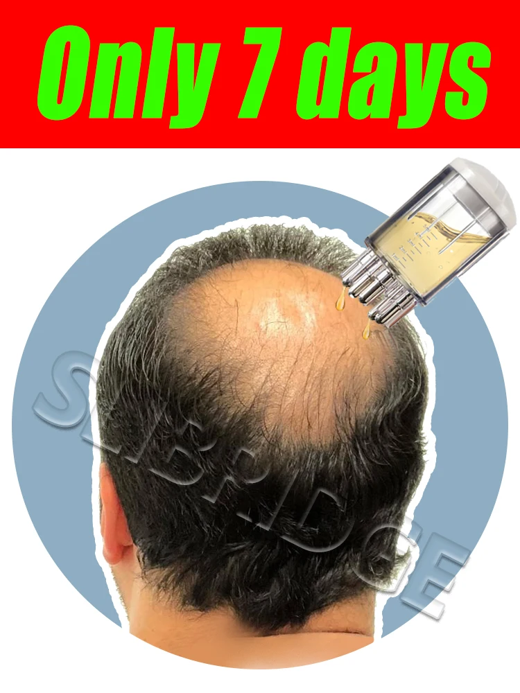 

2025 hot cleaning NEW Scalp Applicator Mini Head Massager Roller Ball Brush Hair Growth Liquid Applicator Massage Comb