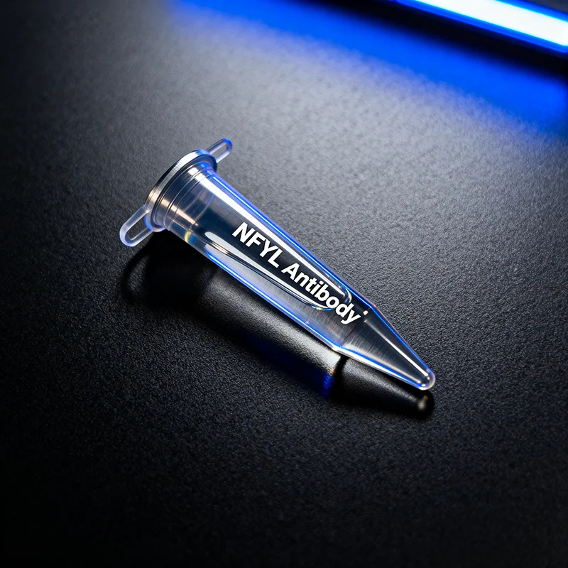 

Анти-Norfentanyl (NFYL) Монокульна Antibody Murine для диагностического обнаружения в матрицах человека (волосы/слине)