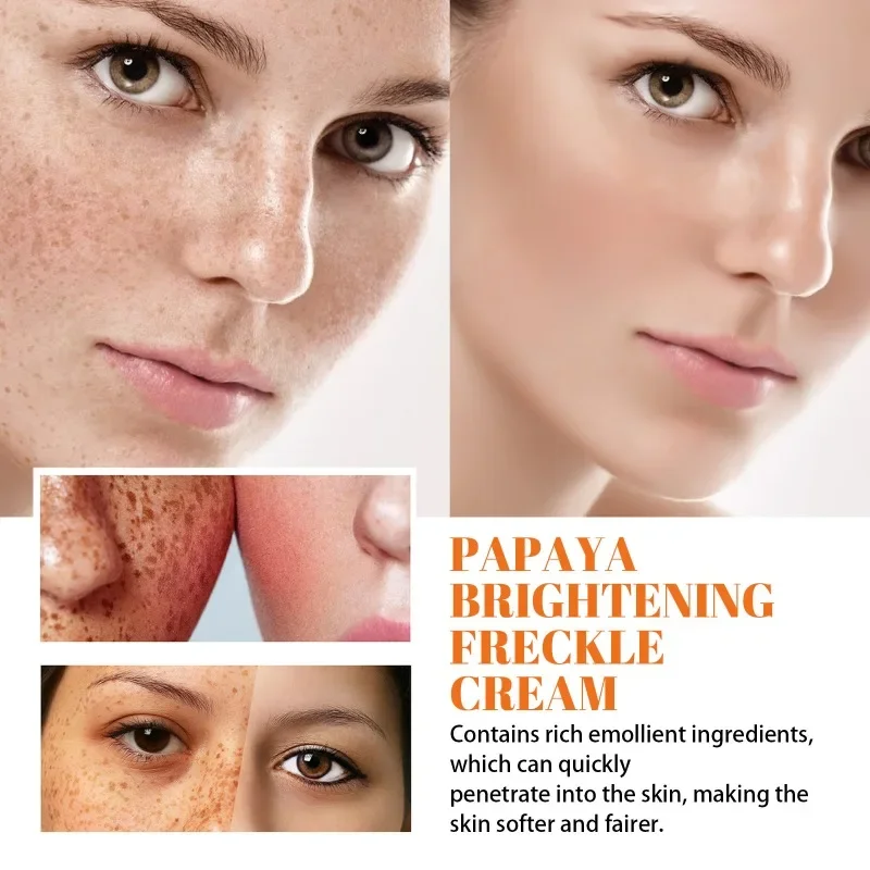 Papaya whitening freckle cream efficace fade facial Melasma macchie scure melanina anti Aging brighten idratante cura della pelle