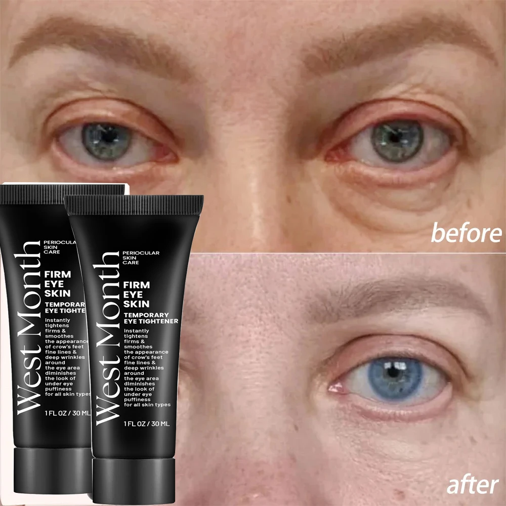 ﻿ Eye Bag Removal Cream Instant Firm Eye Wrinkle Anti-puffiness Fade Fine Line  Dark Circles Under Eye Moisturizing Eye Care Gel