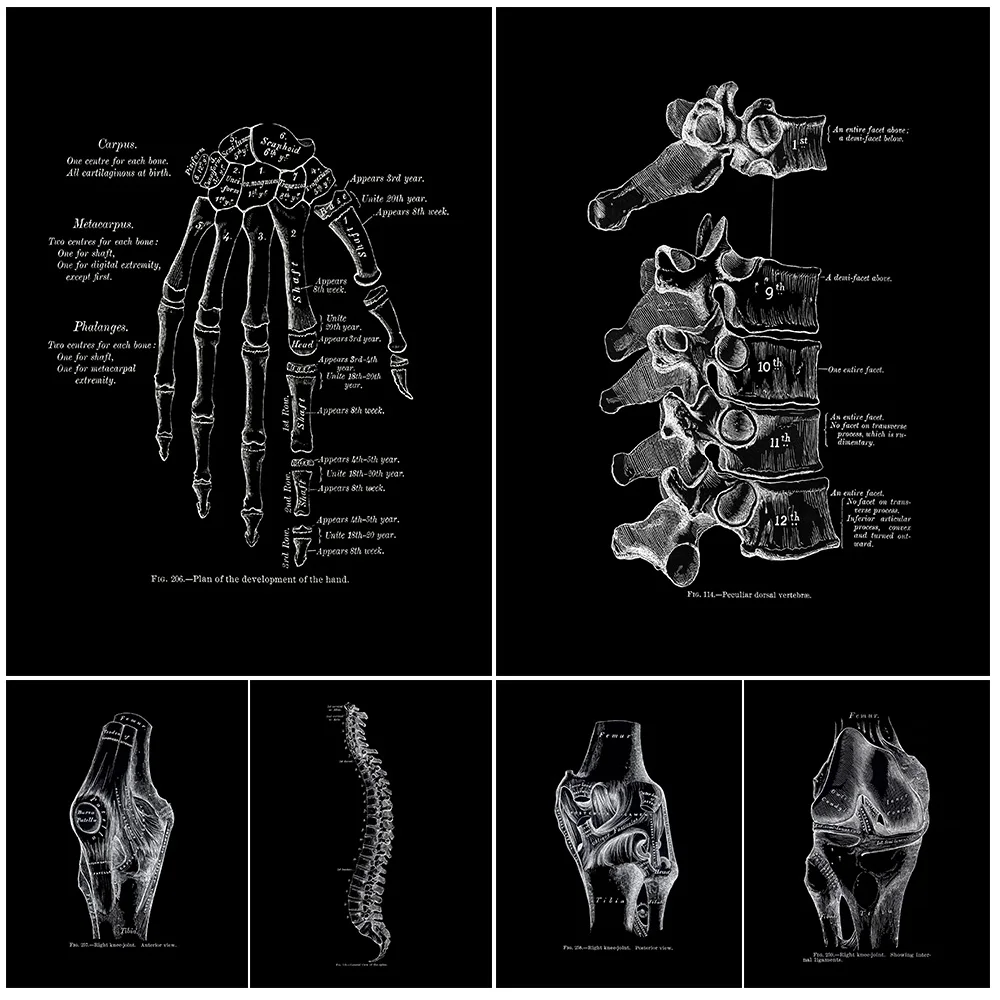 X-Ray Medical Model Spine Osteology Hand Bones Poster Wall Art Canvas Painting Home Decor Wall Pictures For Living Room Unframed
