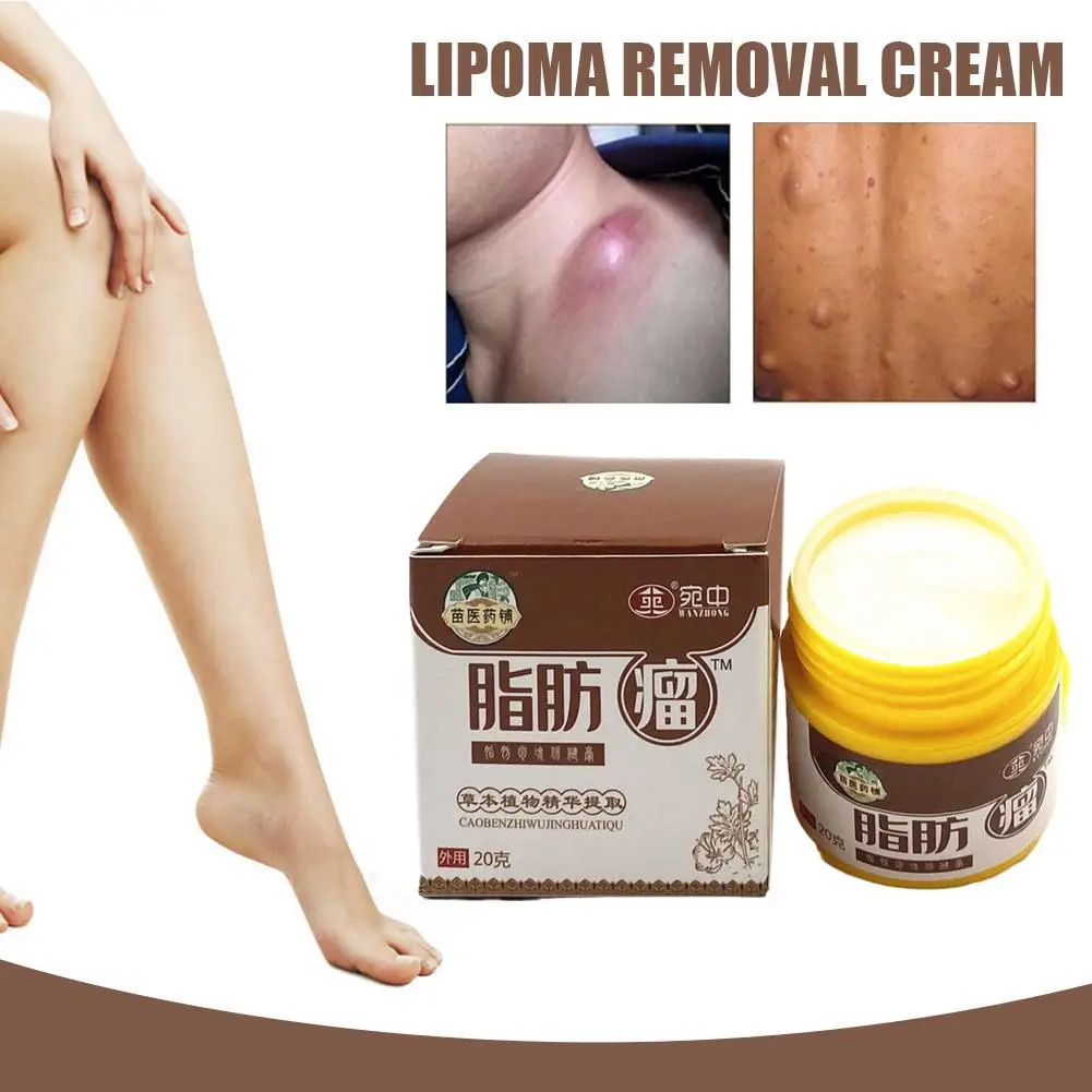 20g Lipoma Cream trattamento per la rimozione di grumi sottoscocca liquido medicinale applicare al gonfiore della pelle Cellulite Fibroma grasso intonaco di massa