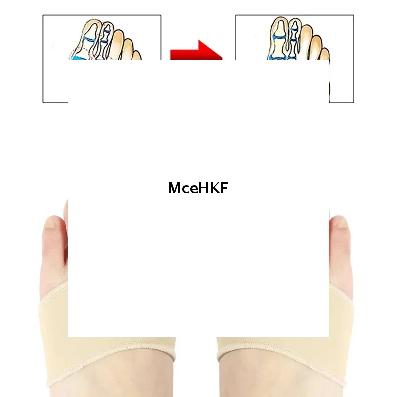 زوج واحد من مصحح الورم، فاصل أصابع القدم للاسترخاء في أصابع القدم الكبيرة، نشر وتمتد لحماية دعم أروح الورم #1