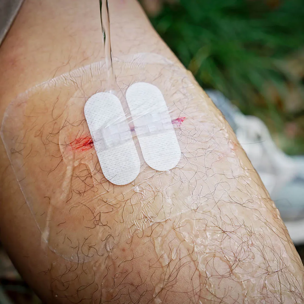 RHINO RESCUE Kit de cuidado de corte - Tiras de cierre de heridas con puntada con cremallera para dispositivo de cuidado de cortes Camping en casa