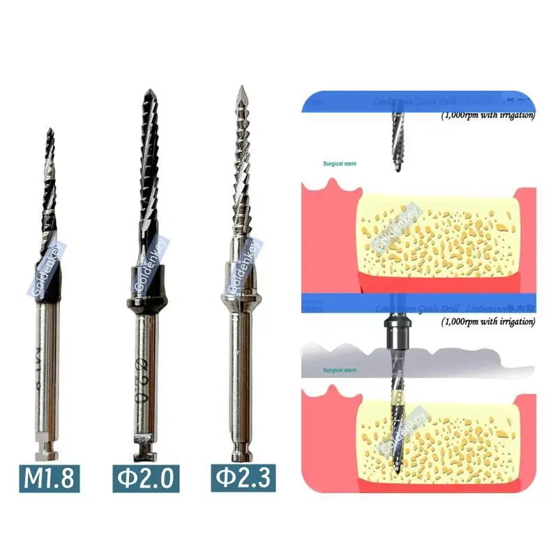 3Sizes Dental Guide Drill Cross Cutter Pilot Drill Lindemann Pioneer Bone Leval Cut Blade Fits Dentium