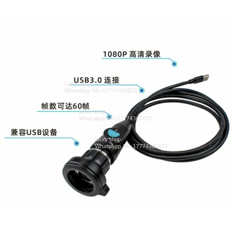 High Definition Endoscope Camera Computer Using High Definition 60 Frames